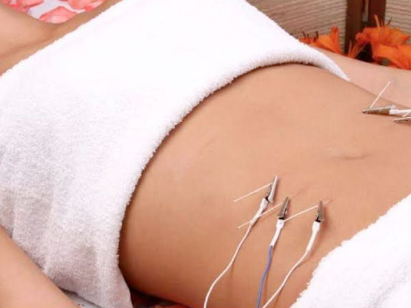 Electro Lipolisis